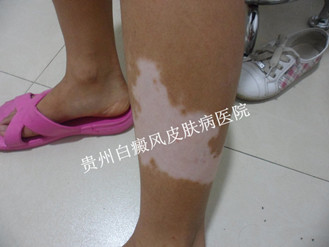 �Ȳ����ְ����ԭ����ʲô