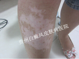 ʲôԭ�����Ȳ�������ɢ��