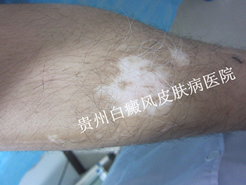 �Ȳ����综����ע������