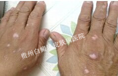 �ֲ���������ʲôԭ���µ�?