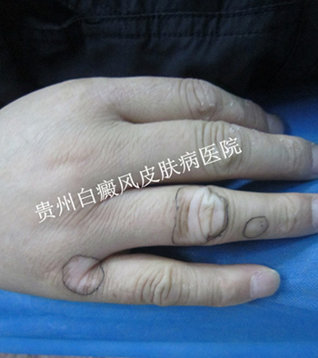 �ֲ�����Ի��ߵ�Σ��