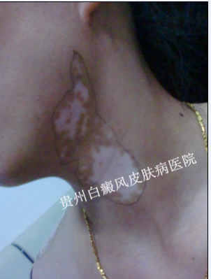 ��������Ի�����ɵ�Σ��