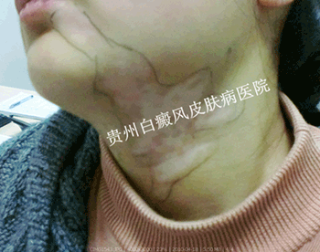 �������������ԭ��