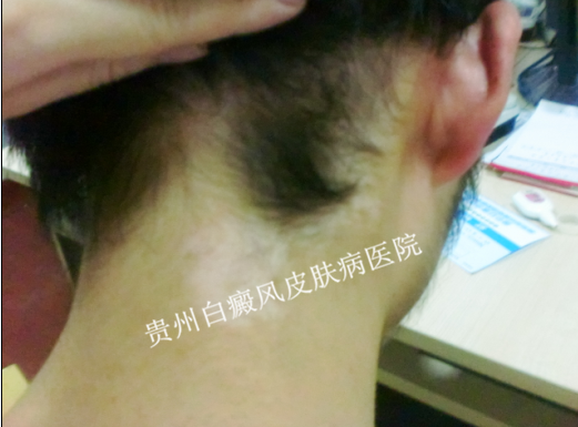 Ů�Ծ�������Ҫע��ʲô