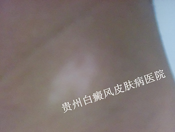 ���������������κ���