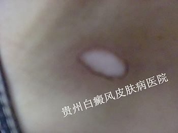 ���¾�������Ĳ�������Щ