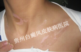 Ů���ز���������������