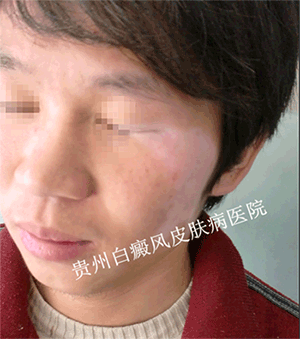 �����沿���������������ʲô��