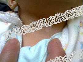 ��ͯ���粡�����Σ����