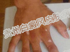 Ԥ�����������ķ�����