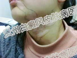 ��������粡�к��������ƣ�