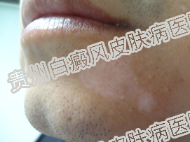 ����Ϊ��ƫ�������ꣿ