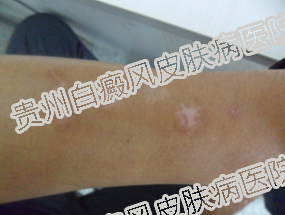 ���԰��磨�װߣ�������ô������