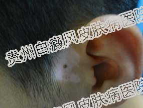 ��������Ի��ߵ��˺��ж��