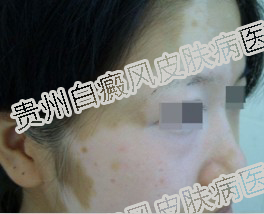 Ů�԰�������Щ֢״��