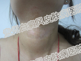 Ů�Եİ��综�߷�����ʲô�ص��أ�