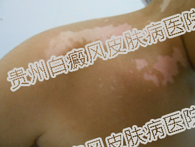 Ů�԰�����ô�����أ�