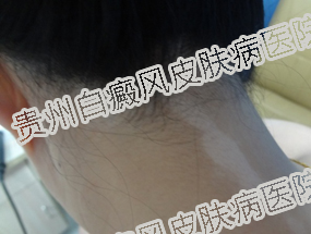 �����Ů�����ѵ�Ӱ������Щ��