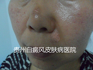 ���综����ʳ