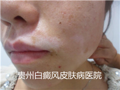 ���粻������ЩΣ��