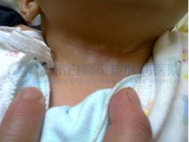 ���������԰����ԭ����ʲô��