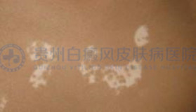 ɢ���Ͱ����򷺷��ͷ�չ��������ֹ��