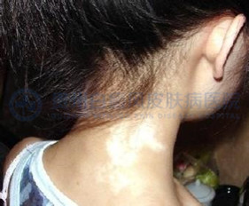 ɢ���Ͱ����ճ�ע�����