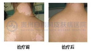 ���Ԥ��ɢ���Ͱ����أ�