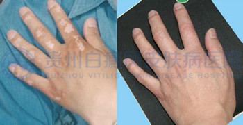 ���֫���Ͱ�������ЩҪ��