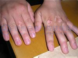 ����֫���Ͱ����Ĵ�ע������