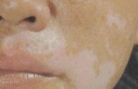 �����������κ���