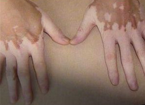 �����а���Ҫע����Щ����