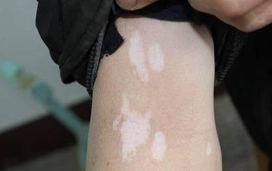 �ֲ������Σ�����ж��