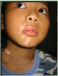 ר��ȫ���𣺰�����Ŵ���