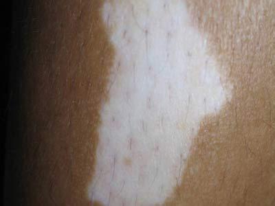 �����Ƿ��Ŵ�