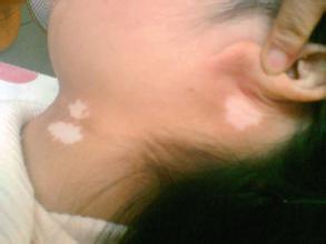 ������β�����ԭ������Щ��