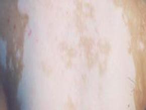 Ů���ز�����Ӧ��������