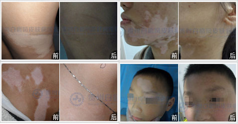 ���������ΰ���ã�