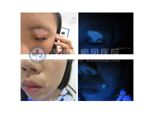 �ҵ�18�� �����ð���������