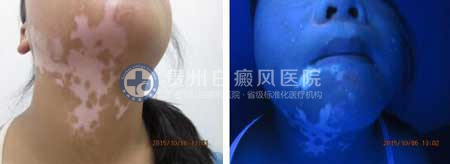 ñ���µ��ഺ ��չ˫�����ɷ���