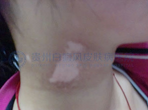 ��������Σ������Щ