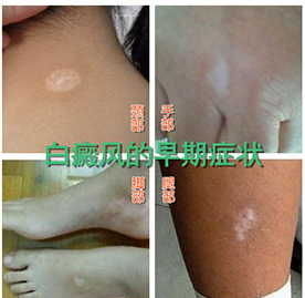 �����ڷ���ǰ��������