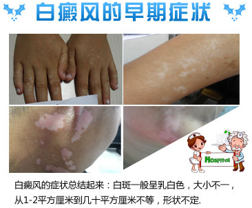 ���ɱ��װ�֢״����Ҫ��Ϊ���絢���˽���