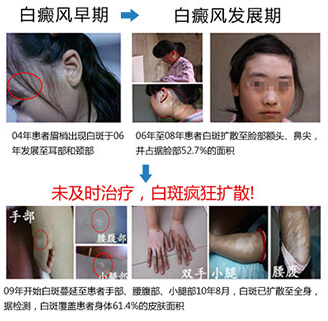 ���粻ͬʱ�ڶ���Щʲô֢״