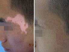 ���԰�����ʳ����Ҫע����Щ����