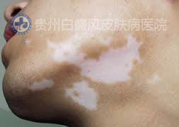 ʲôʳ������԰��综���к�