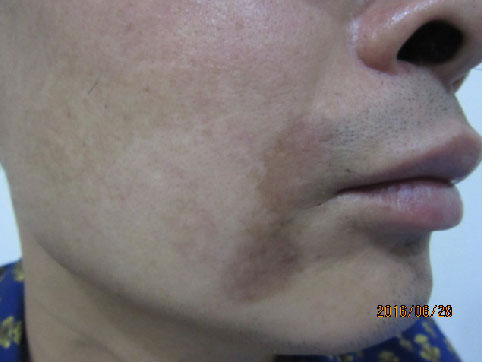 �������Է������粡������Щ