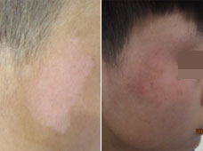 �������԰���ȽϺõķ�����ʲô