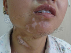 ���к���ô�ܱ�����縴��