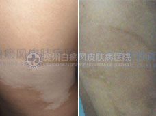 ���Ա��������Ͱ���5��